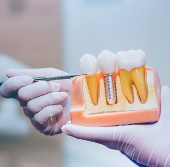 Dentist pointing to dental implant model in Williamstown